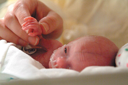 Developmental care1